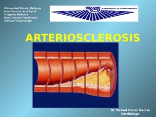 fispa arteriosclerosis.pptx